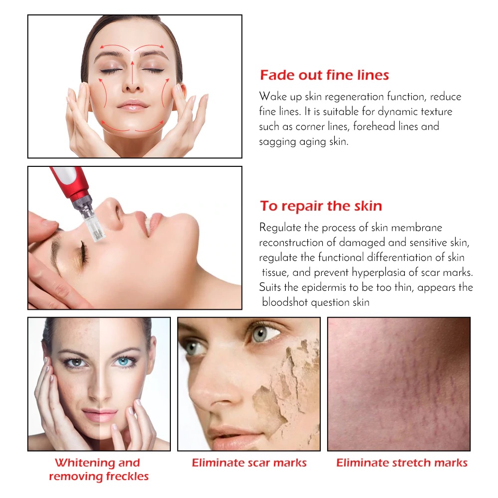 Electric microneedling pen needle tips - Dermal Shop